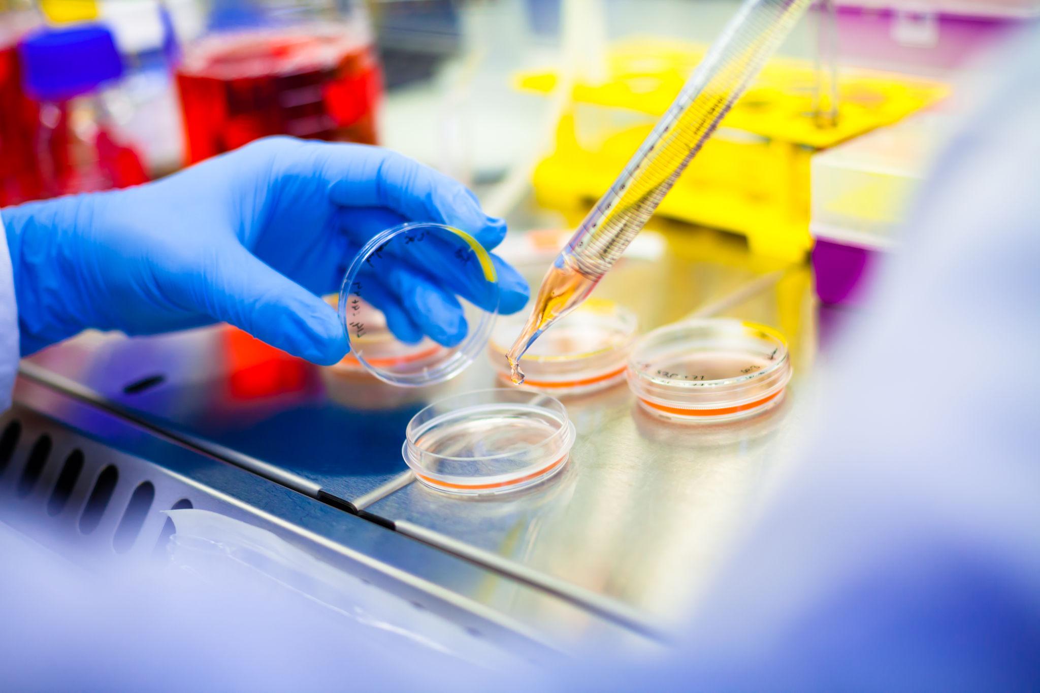 Culture plates in the lab