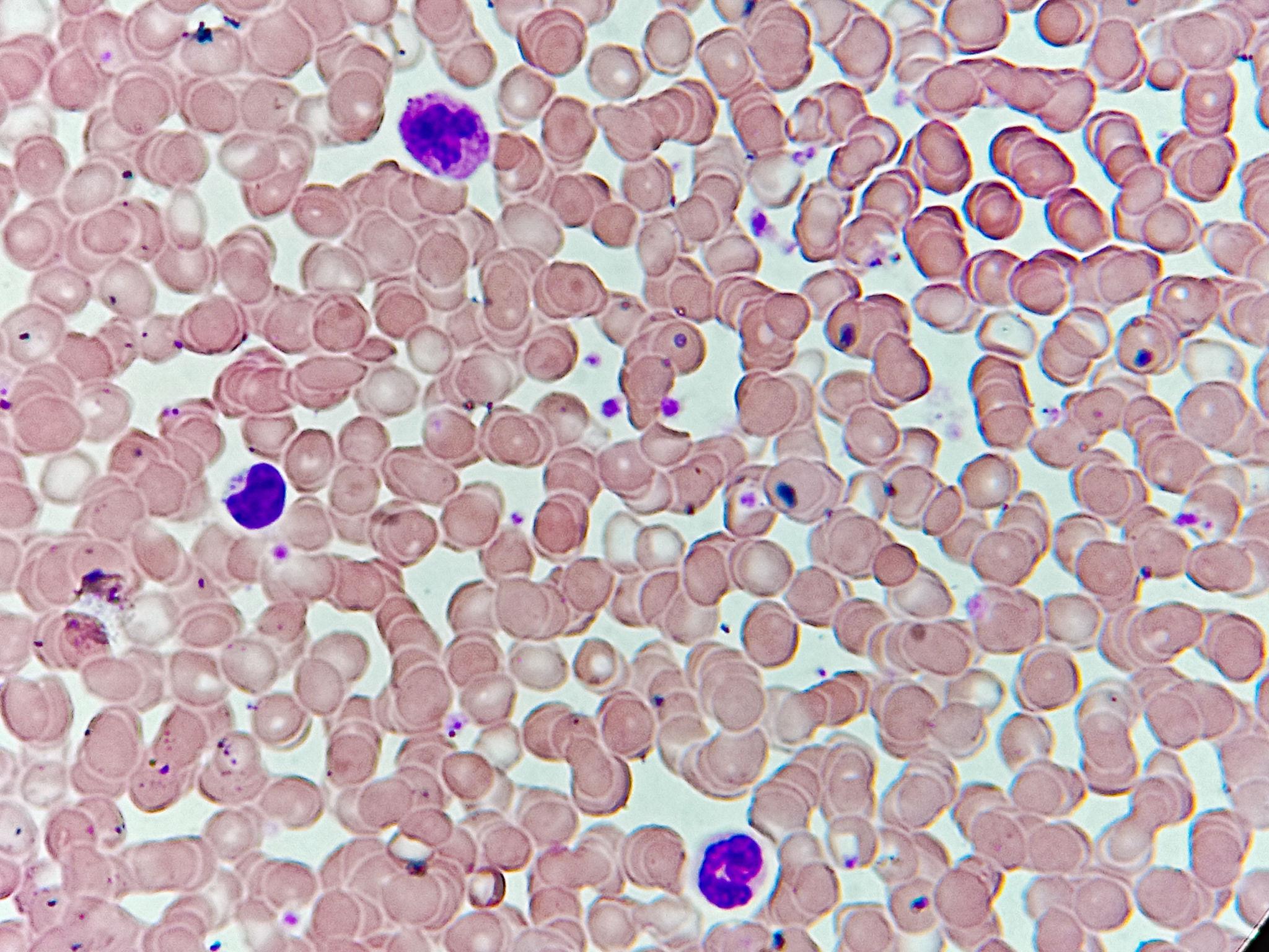 Hematopoiesis
